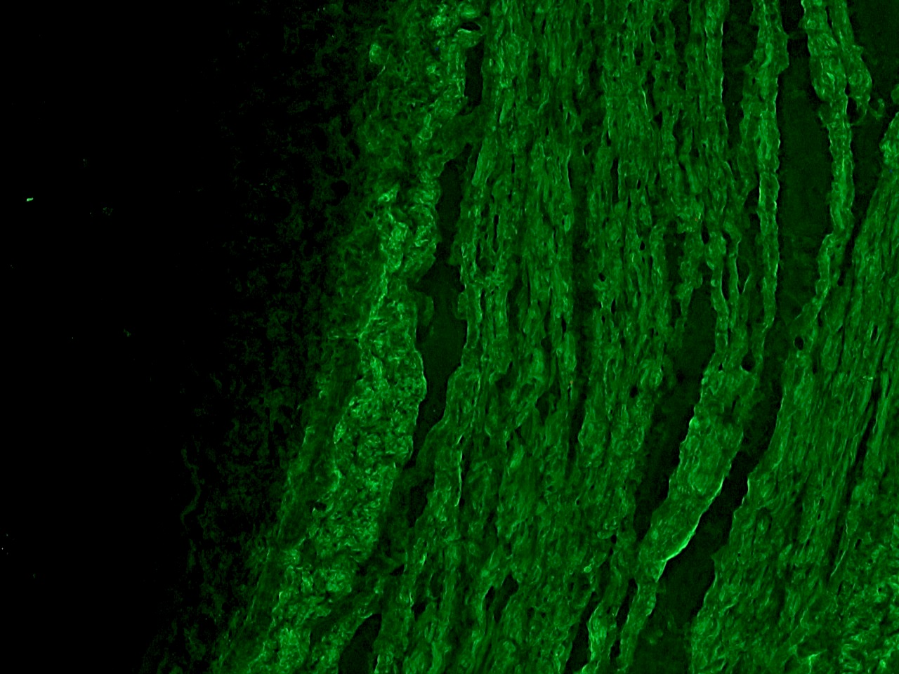 Figure 1. Indirect immunofluorescence staining of frozen section of chicken gizzard with MUB0107P (HHF35) showing specific positive staining of smooth muscle cells.